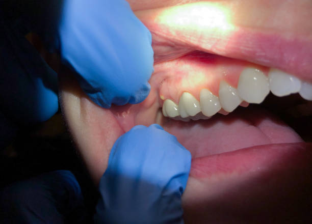 Best Weekend Emergency Dentist in Garrett, TX